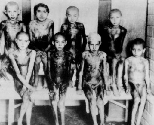  Nazi Deneyleri: Unutulmaz Korkunç Gerçekler ve Tıp Tarihine Etkileri