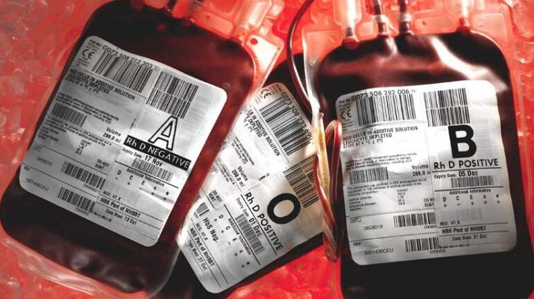  Antijen İçermeyen Kan Grubu “Altın Kan”: Rh-null