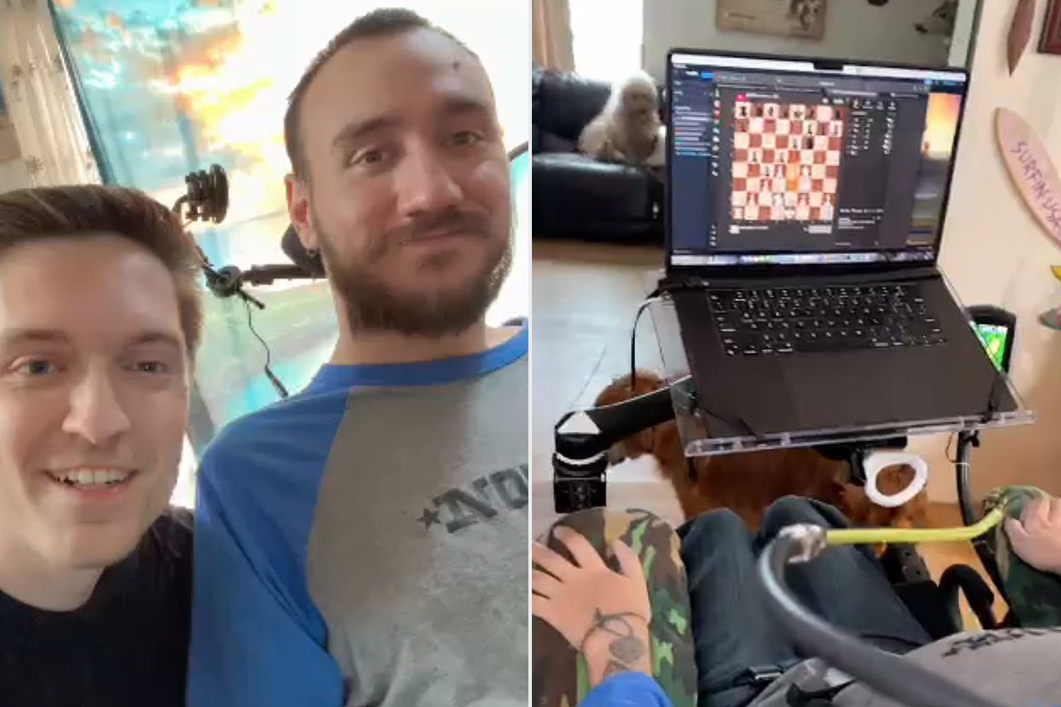 Stroke Patient with Neuralink Brain Chip Plays Games Using Mind Power!