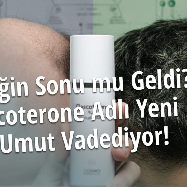 Kelliğin Sonu mu Geldi? Clascoterone Adlı Yeni İlaç Adayı Umut Vadediyor!
